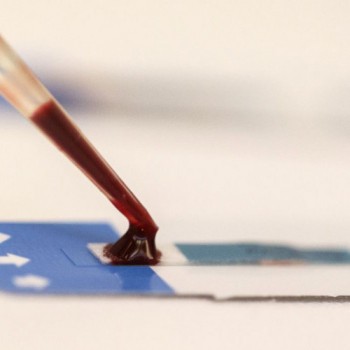 Pesquisadores desenvolvem nova abordagem para combater vírus da Aids
