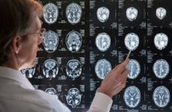 Agosto é mês da Esclerose Múltipla e conscientização é importante