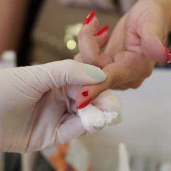 Ferraz fará testes de Covid em bairros com mais casos