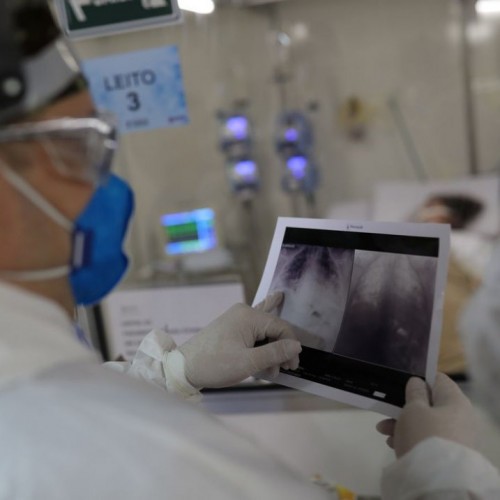 Covid-19: Brasil tem aumento de mortes e registra 2.841 óbitos