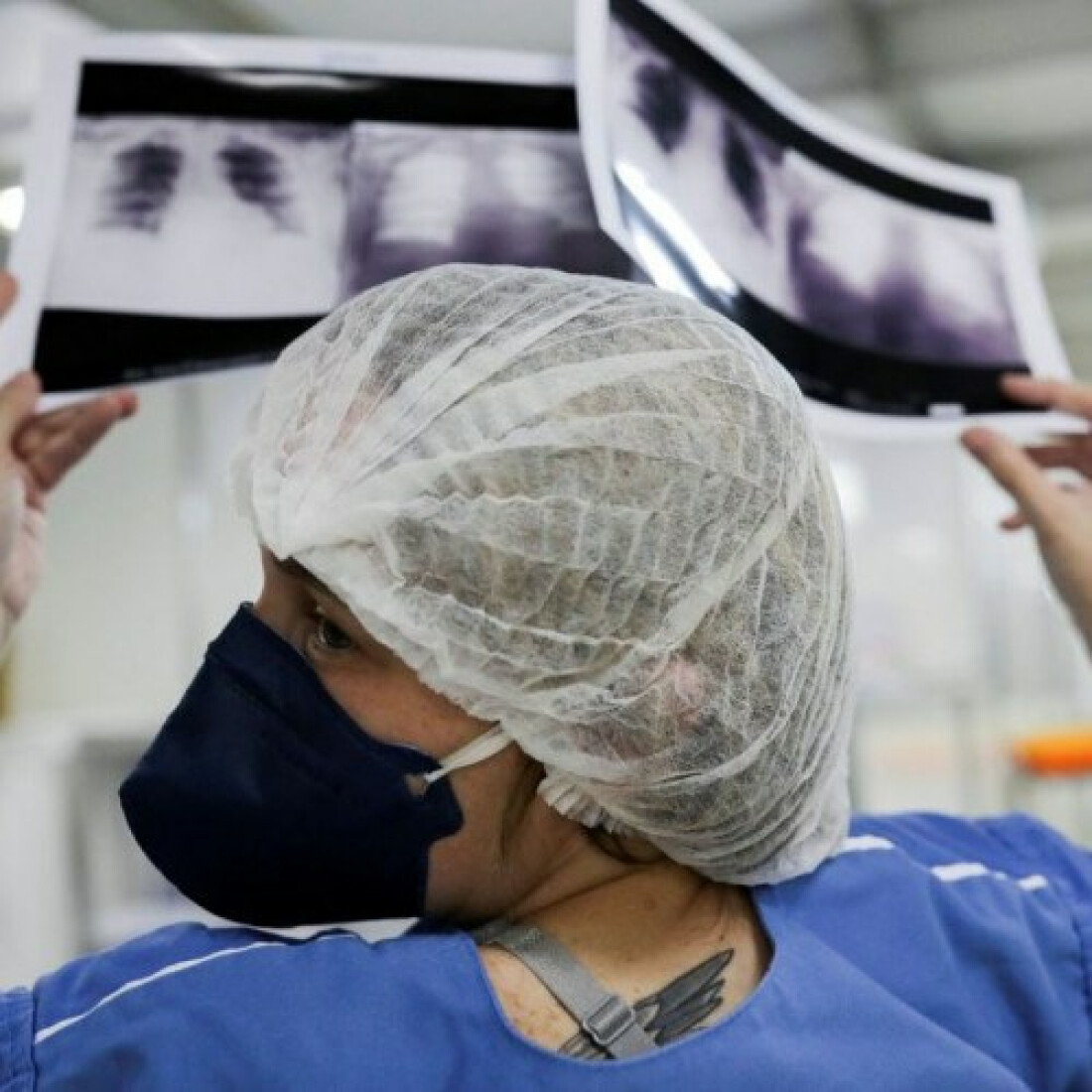 Fiocruz: 18 estados e DF têm ocupação de leitos de UTI acima de 80%