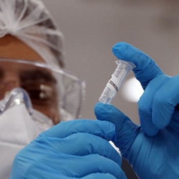 Covid-19: Brasil registrou 62.715 infectados em 24 horas