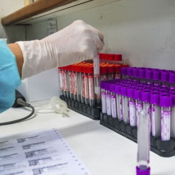 Primeira reinfecção por covid-19 no Brasil foi em julho, diz estudo