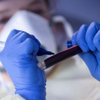 Covid-19: óbitos passam de 240 mil e casos somam quase 10 milhões