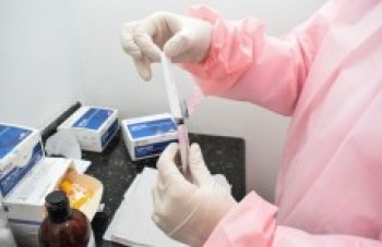Número de casos de Covid-19 cai em relação às notificações