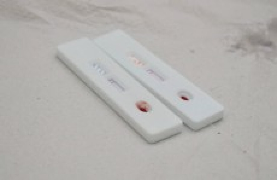 Quantidade de testes feitos da Covid-19 cai 28% em setembro