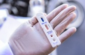 Com novo critério, cidade que testar mais será prejudicada