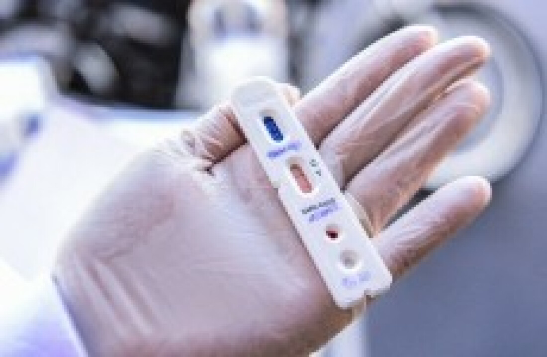 Com novo critério, cidade que testar mais será prejudicada