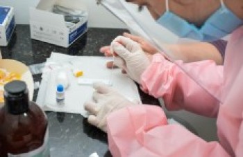 País já possui 1% da população infectada