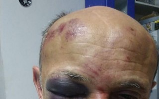 SIG investiga ações individuais em agressão ao guarda de Mogi