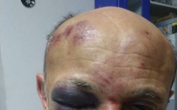 SIG investiga ações individuais em agressão ao guarda de Mogi