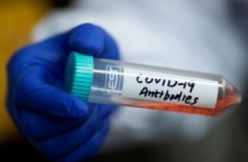 Segundo OMS, China protelou liberação de dados sobre Covid