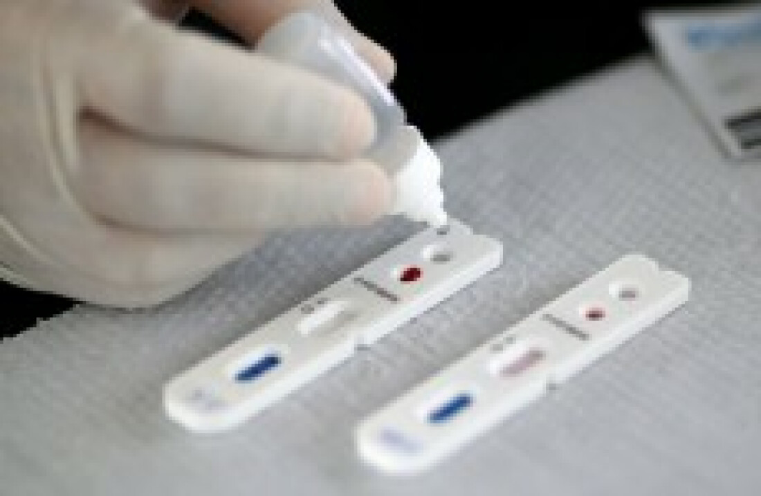 Israel anuncia descoberta de anticorpo para Covid-19