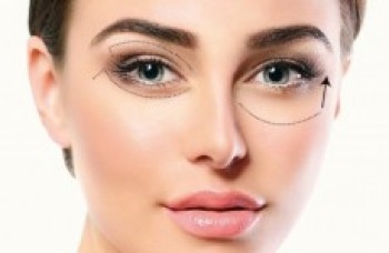 Oculoplástica cuida da região dos olhos