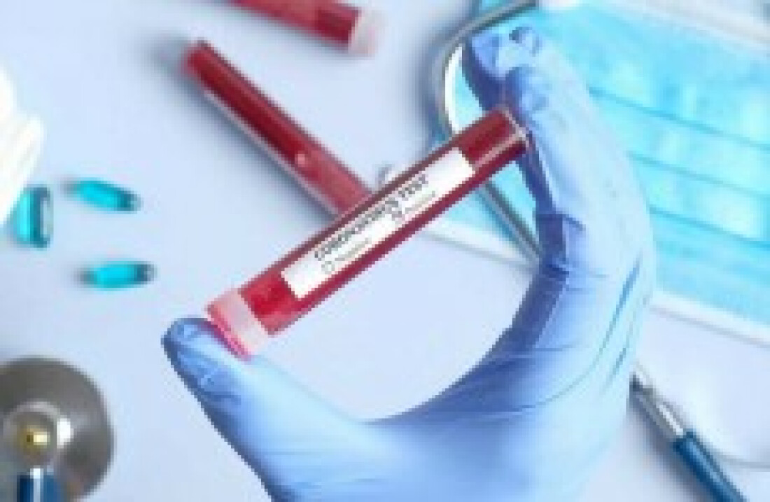 EUA têm quase 2 mil mortos em 24 horas