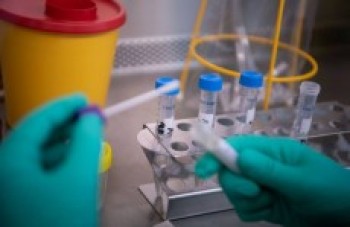Mogi terá 10 mil testes rápidos para coronavírus