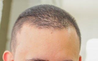 População fala sobre a importância das vacinas contra o sarampo