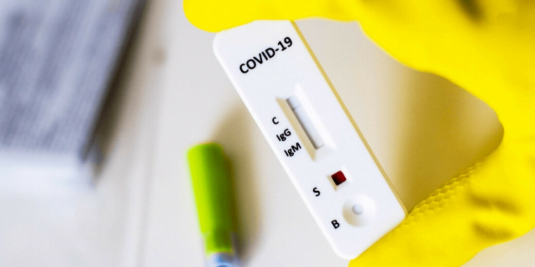 Alto Tietê mostra tendência de queda no número de casos