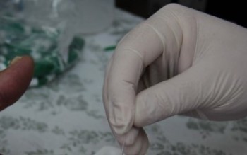 Secretaria de Saúde realiza exames para detectar o HIV