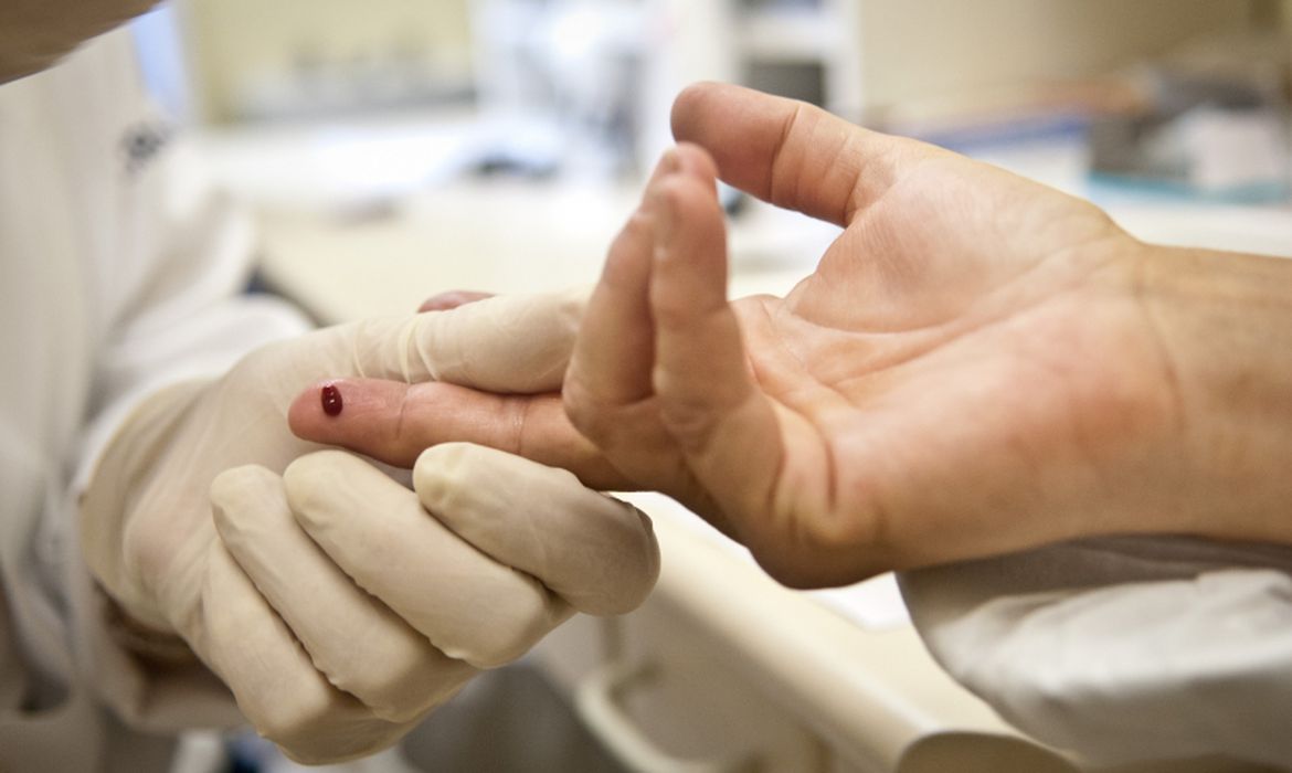 Rio: Justiça proíbe exigência de teste HIV para candidato a concurso