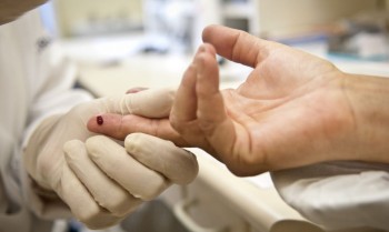 Rio: Justiça proíbe exigência de teste HIV para candidato a concurso