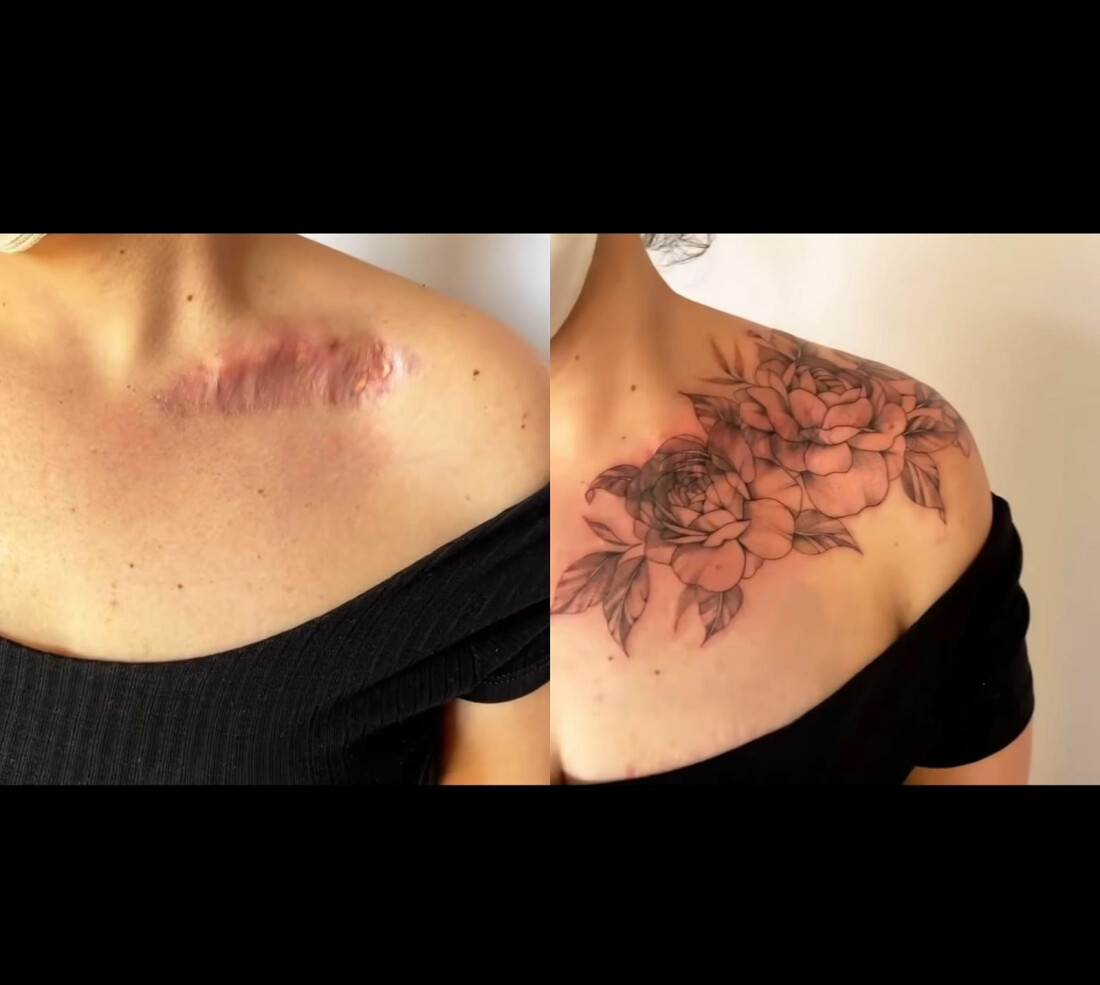 Tatuadora ressignifica marcas de mulheres vítimas de violência doméstica 