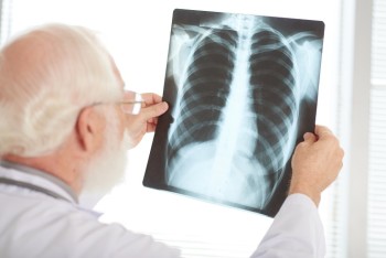 Campanha Agosto Branco busca reduzir casos do câncer de pulmão