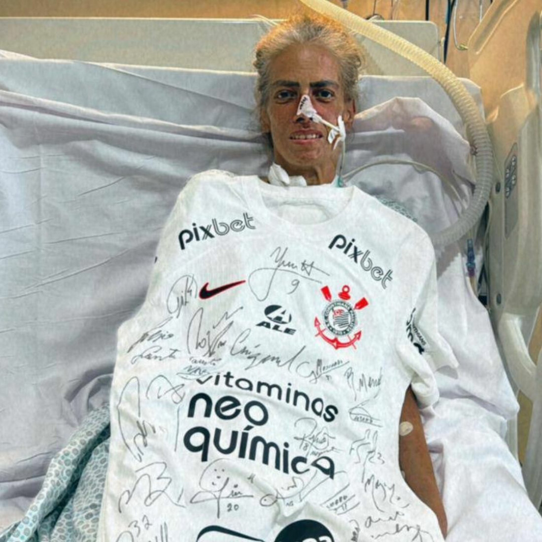  Professora é diagnosticada com doença rara, a síndrome de POEMS 