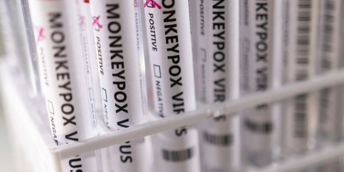 Alto Tietê passa dos 70 casos confirmados de Monkeypox