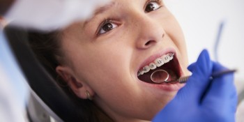 APCD Mogi oferece atendimento ortodôntico