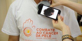 "Dezembro Laranja" chama atenção para câncer de pele
