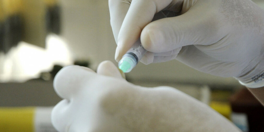 Vírus HPV pode ficar no organismo durante anos