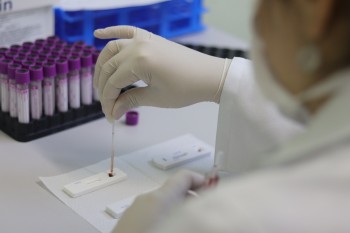 Suzano reforça ações de prevenção às hepatites virais nos postos de saúde