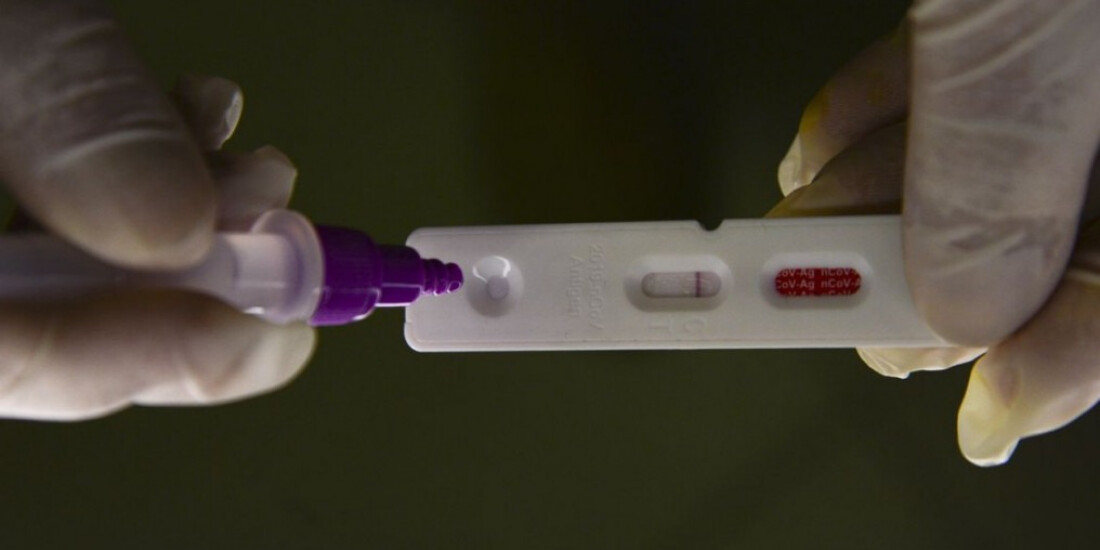 Hospitalizações por covid-19 mantêm tendência de alta nos estados